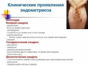 Может ли болеть живот и поясница при эндометриозе