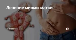 Опухоль на матке психологические причины