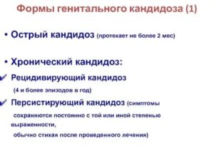 Симптомы молочницы в острой форме