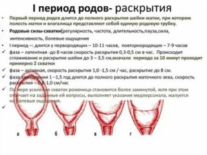 Влияние дюфастона на раскрытие шейки матки