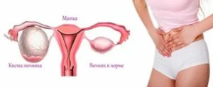 Могут ли быть увеличены яичники перед месячными