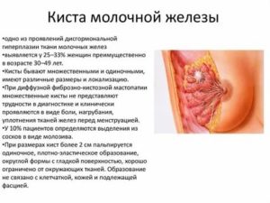 Могут ли рассосаться кисты в молочных железах при климаксе