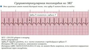 Когда месячные сердцебиение от чего