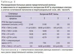 Что означает зно предстательной железы