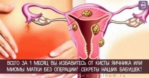 Может ли быть задержка месячных из-за кисты в одном яичнике