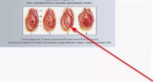 Когда девственности лишаешься может ли быть сбой в месячных