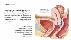 Может ли кровь от месячных попасть в брюшную полость