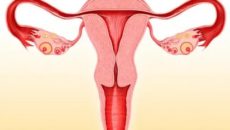 Тонкий эндометрий после отмены противозачаточных