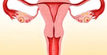 Тонкий эндометрий после отмены противозачаточных